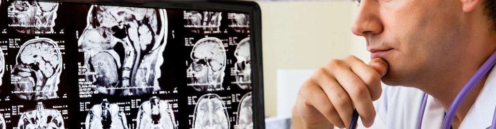 Untitled design (13) traumatic brain injury